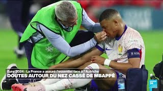 Euro 2024  inquiétude après la fracture du nez de Mbappé • FRANCE 24 [upl. by Siednarb]