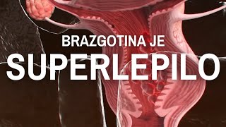 Brazgotine v trupu povzročajo omejitve neodvisno od starosti [upl. by Ygief602]