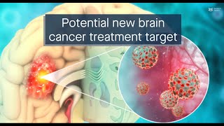 The FAKZDHHC5 axis a potential new treatment target for glioblastoma [upl. by Smailliw902]