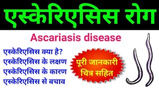 एस्केरिएसिस क्या है  ascariasis class 12  ascariasis microbiology  ascariasis disease in hindi [upl. by Story]