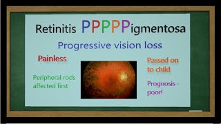 Retinitis Pigmentosa Mnemonic [upl. by Tanitansy]