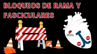 Bloqueos de rama y fasciculares hemibloqueos [upl. by Arlee635]