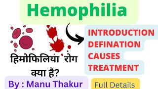 Hemophilia Definition causes treatment what is HemophiliaFull Details Hemophilia in hindi [upl. by Eegnat233]