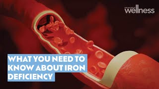 What you need to know about iron deficiency and supplementation [upl. by Mandi]