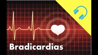 Bradicardia Medicina Mp3 ® [upl. by Aihseya]