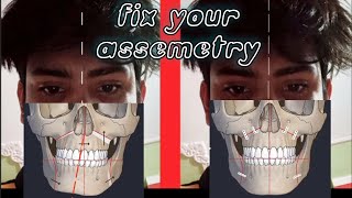 How to fix ASYMMETRICAL FACE NATURALLY [upl. by Marcus]