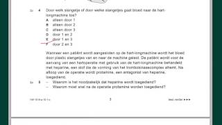 VWO biologie Examenuitleg 2010 tijdvak 1 vr 15 en 2835 deel 1 [upl. by Giarla]