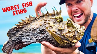 Worst Fish Sting Stung by a Stonefish [upl. by Lubeck]