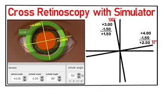 Cross Retinoscopy with Simulator How practice with Simulator [upl. by Gelya]