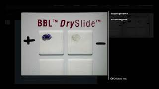 Oxidase Test DrySlide  Microbiology [upl. by Norym802]