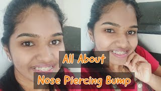 All About Nose Piercing Bump  Explained  Malayalam [upl. by Bartram]