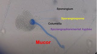 Mucor under the Microscope [upl. by Jeavons]