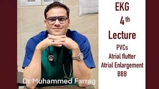 4th lecture  PVCs atrial flutter BBB amp atrial enlargement [upl. by Reade287]