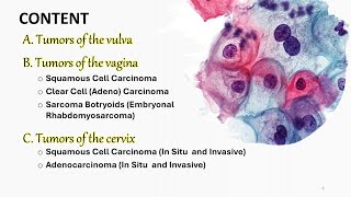 Female genital Tumors Part 1شرح محاضرة VulvaVaginaCervix neoplasms [upl. by Fannie]