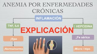 Anemia por Enfermedades Crónicas Explicación [upl. by Rotsen]