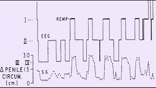 Tecniche psicofisiologiche 3 [upl. by Christiansen]