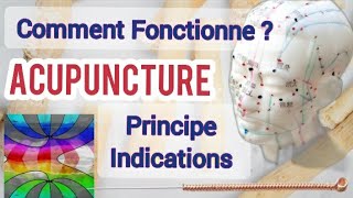 Acupuncture Comment Fonctionne Énergie QI les points Méridiens Techniques principe indications [upl. by Allista]