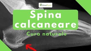 Spina calcaneare cura naturale [upl. by Nyvar]