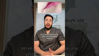 Queilitis dermatólogo skincare dermatologia piel dermatologo queilitis [upl. by Jessalyn]