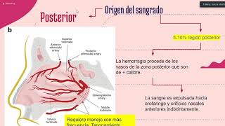 Epistaxis [upl. by Ecirtac]