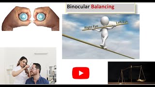 Mastering in Binocular Balancing by Alternate occlusion test [upl. by Iverson484]