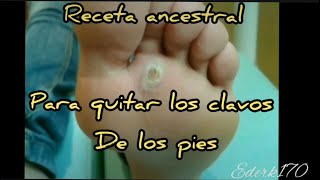 RECETA ANCESTRAL PARA ELIMINAR EL HELOMA PLANTAR O CLAVOS EN LOS PIES [upl. by Llenrap156]